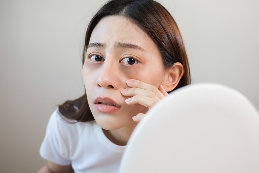 If You Have Dark Eye Circles, Your Body May Be Trying to Warn You