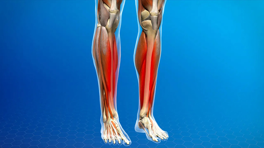The vitamin the body lacks when legs and bones are painful