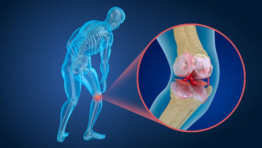 A single ingredient to combat bone pain, diabetes, anxiety, depression, and constipation!
