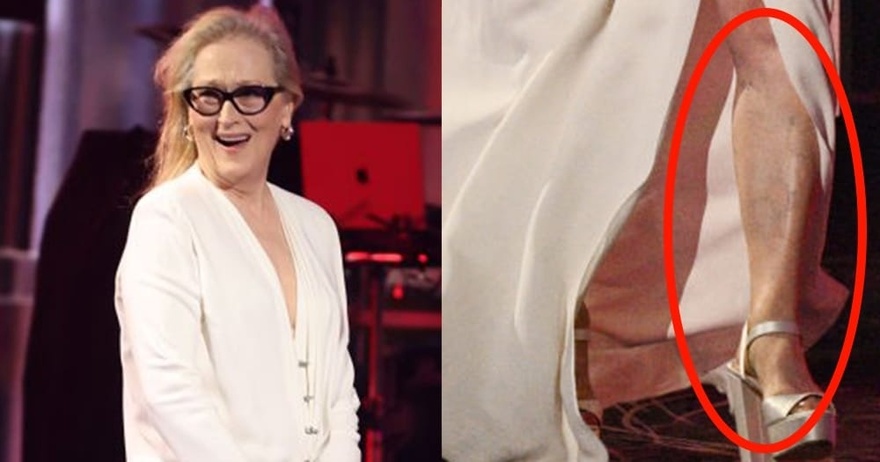 Meryl Streep, 75, stuns in high slit dress — but one detail causes a stir