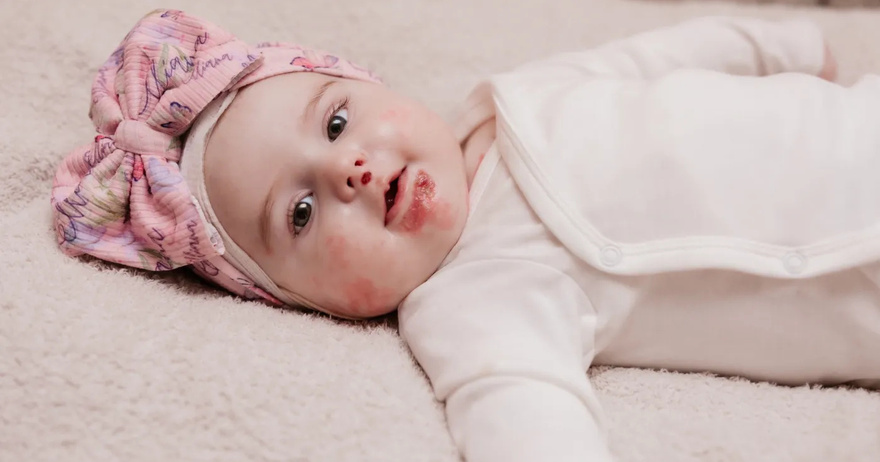 Influencer Hannah Campbell Announces Death of Her 10-Month-Old Daughter: ‘Let’s Fight for a Cure’