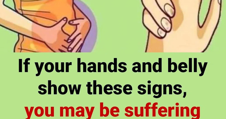 If your hands and belly show these signs, you may be suffering from diebetes without realizing it