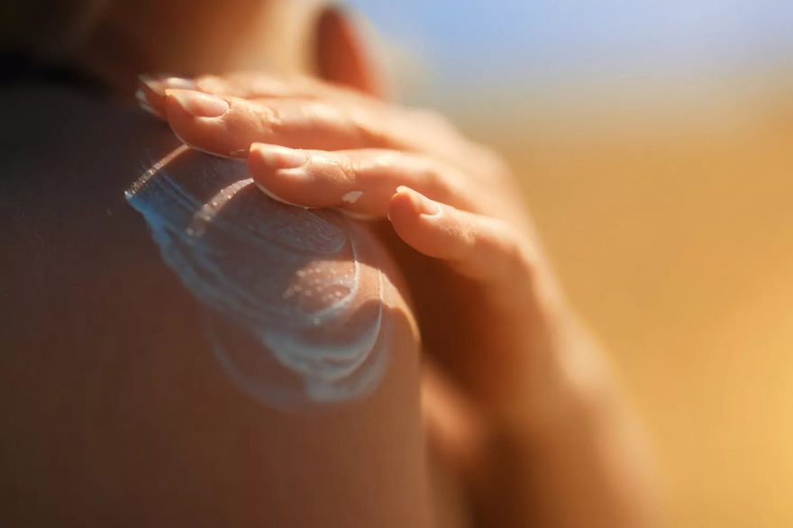 Teen Diagnosed with Stage 3 Melanoma at 15 Says Doctors Initially Dismissed Cancer Symptom as Sign of ‘Puberty’