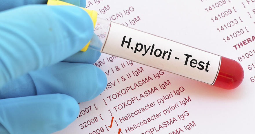 How to treat H. Pylori Bacteria Causing Heartburn And Bloating + Natural Remedies