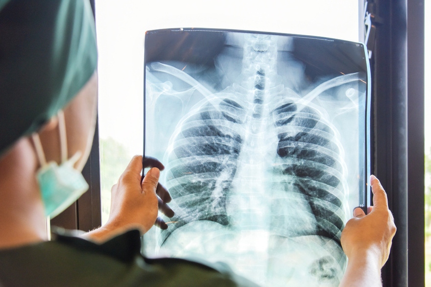 The New Leading Infectious Disease: COVID-19 No Longer Top of the List