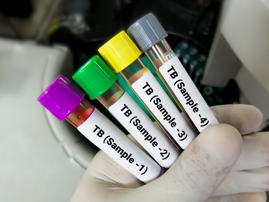 The New Leading Infectious Disease: COVID-19 No Longer Top of the List