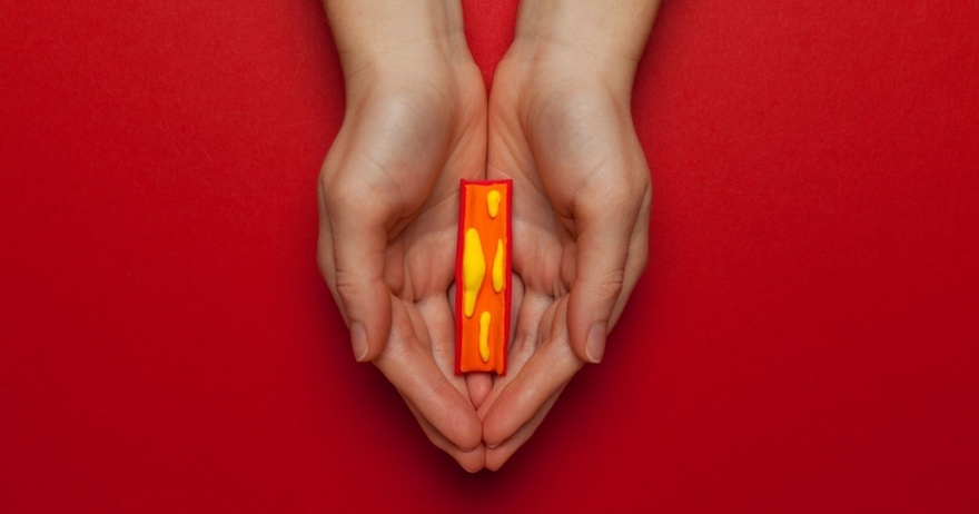10 Signs You’re Living With Clogged Arteries