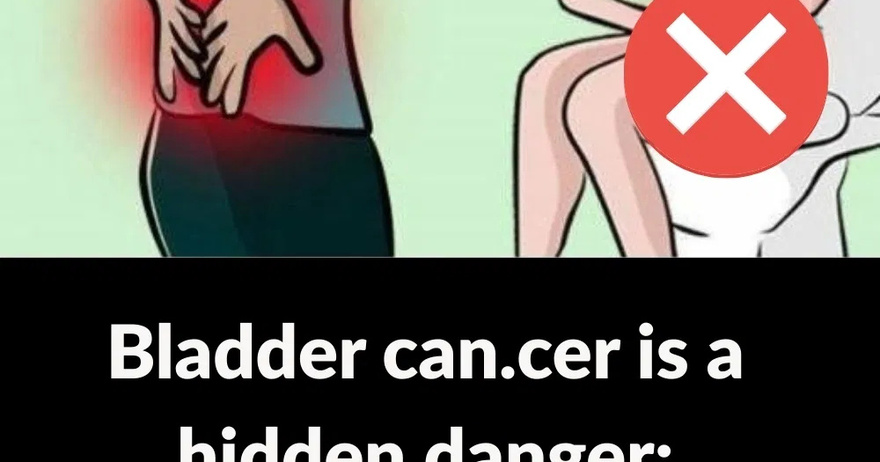 Bladder Can.cer Is a Hidden Danger: 10 War:ning Signs You Shouldn’t Ignore