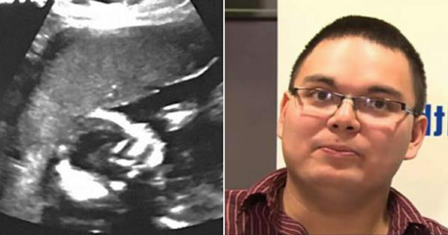 Couple shocked when they see ultrasound – then nurse states that it’s 1 in 15 million
