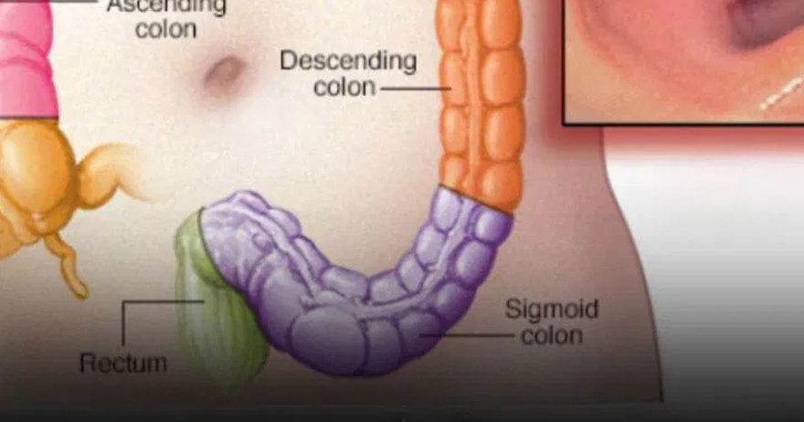 If you see 8 signs, go for an early check-up