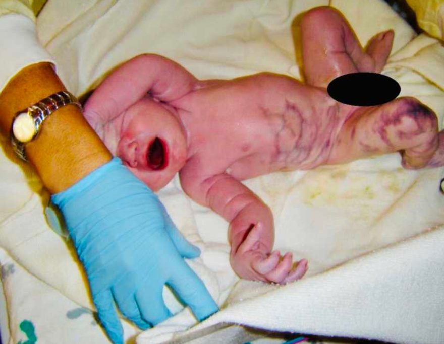 Mom delivers baby, only for dad to utter: “There’s something wrong”