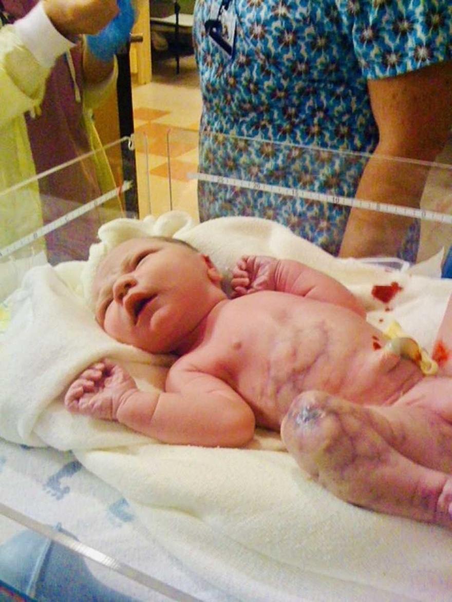 Mom delivers baby, only for dad to utter: “There’s something wrong”