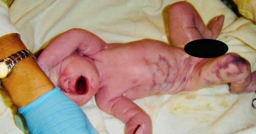 Mom delivers baby, only for dad to utter: “There’s something wrong”