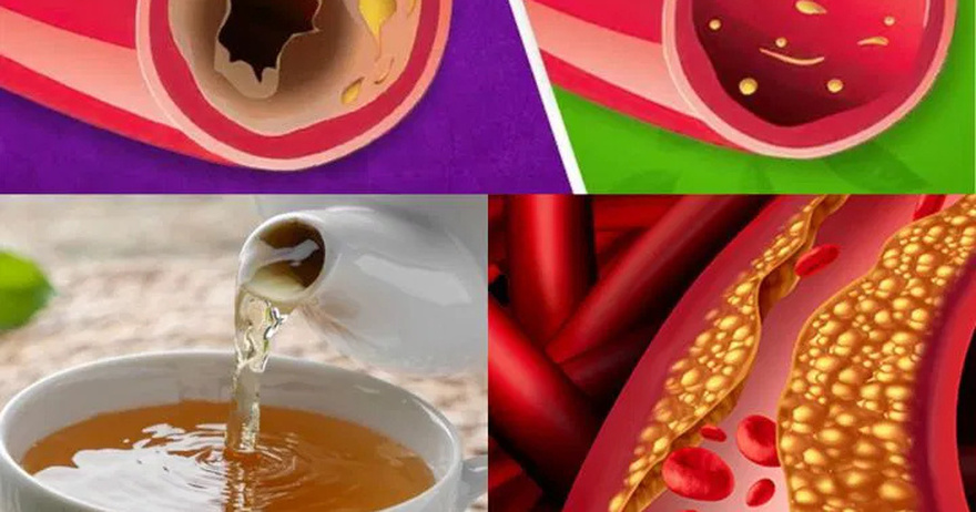 This Tea Cleanses Your Arteries: You May Not Know This!