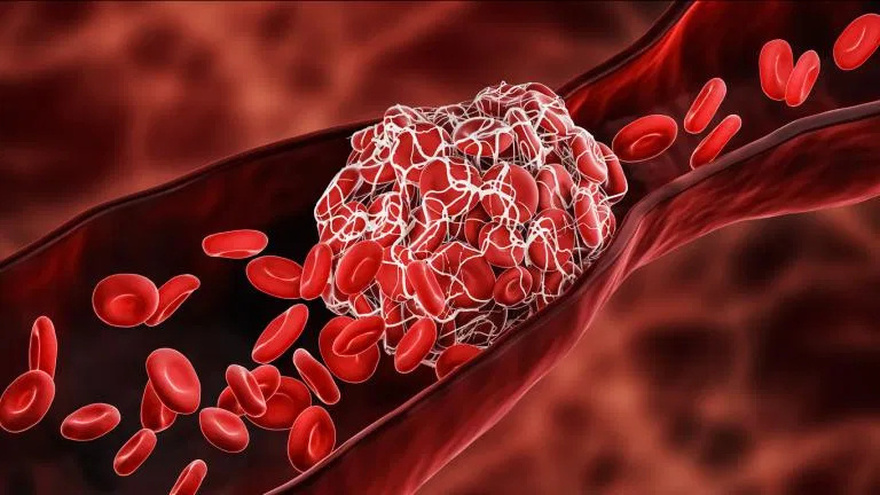 7 Powerful Blood-Thinning Foods You Should Know About