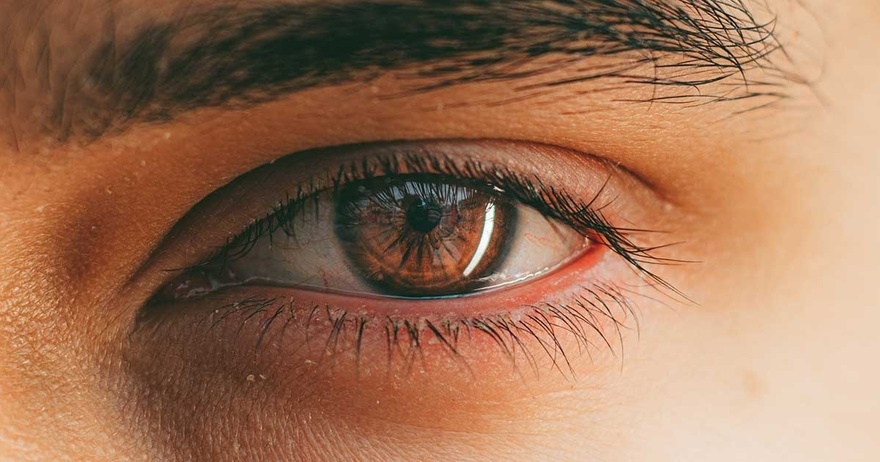 What Are Eye Floaters? Here What To Do If you Start Seeing Them, According to an Eye Doctor