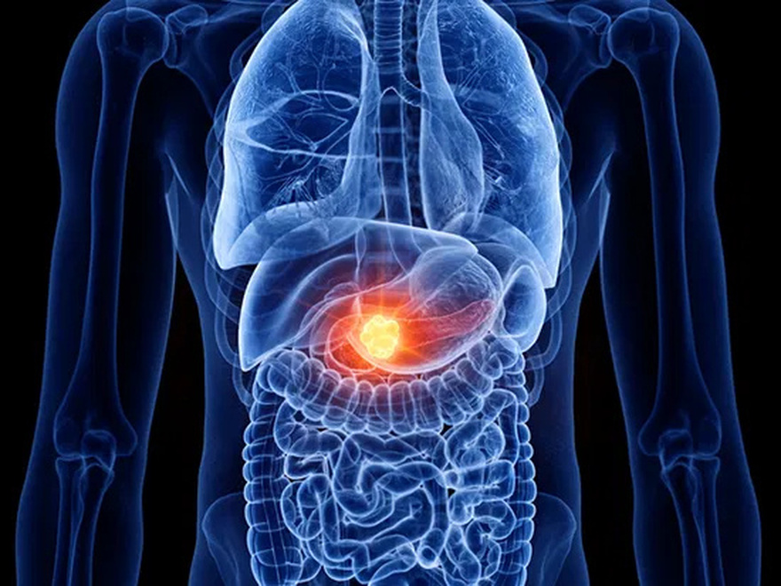 Doctors reveal the one bl00d type which has the lowest risk of canc3r