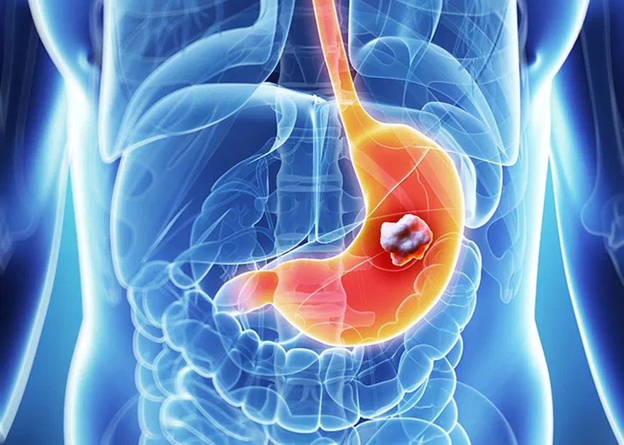 Doctors reveal the one bl00d type which has the lowest risk of canc3r