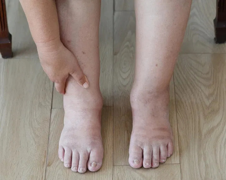 11 Signs Your Body Is Giving You Important Alerts