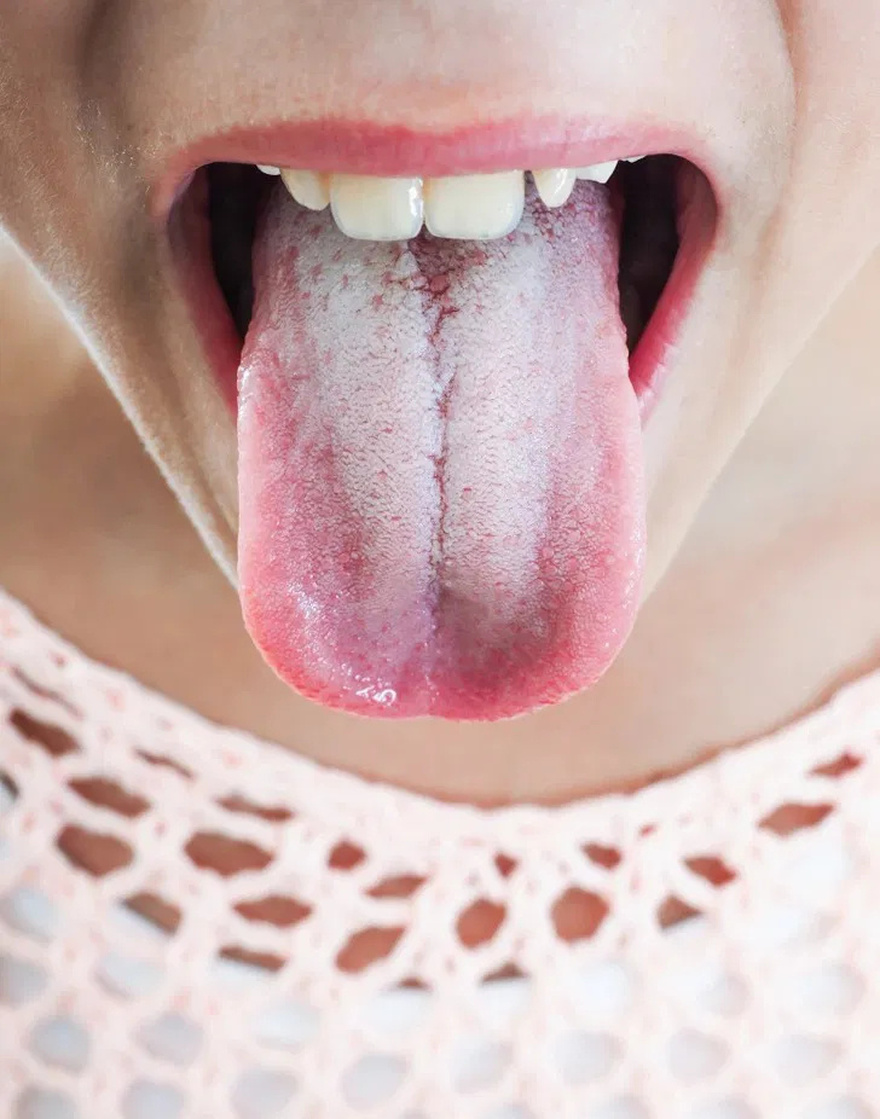 11 Signs Your Body Is Giving You Important Alerts