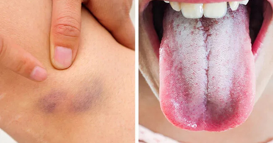 11 Signs Your Body Is Giving You Important Alerts