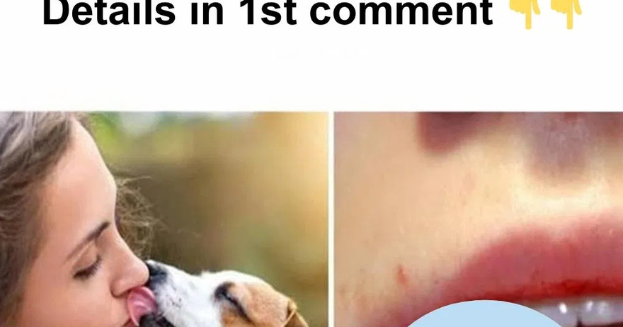 Your Dog Licks You Out of Affection, But This Can Be a Dan:ger for Your Health.