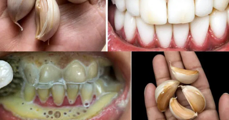 The natural secret to whiter teeth…