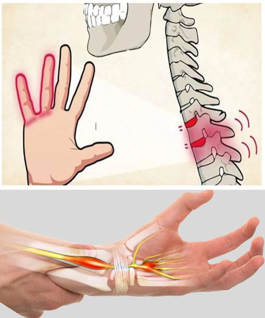 What does numbness and tingling in your limbs mean? Here are some serious causes of this feeling