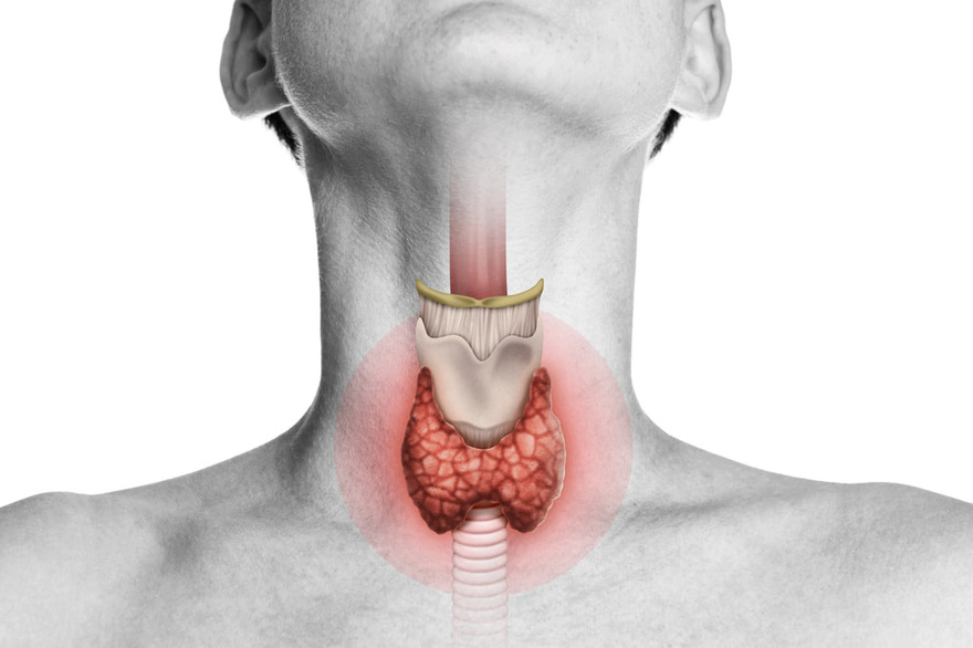 Cases of thyroid can:cer are increasing rapidly. Doctors advise you to eat less of these foods