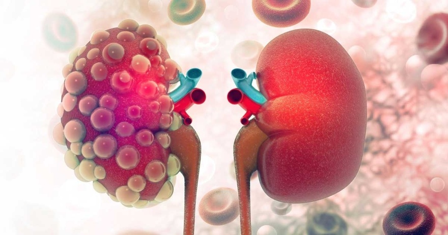 If Your Kidneys Are in Danger, the Body Will Show these 10 Signs