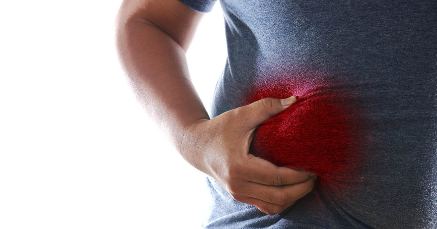 Fatty Liver: Causes, Symptoms, Treatment & Home Remedies