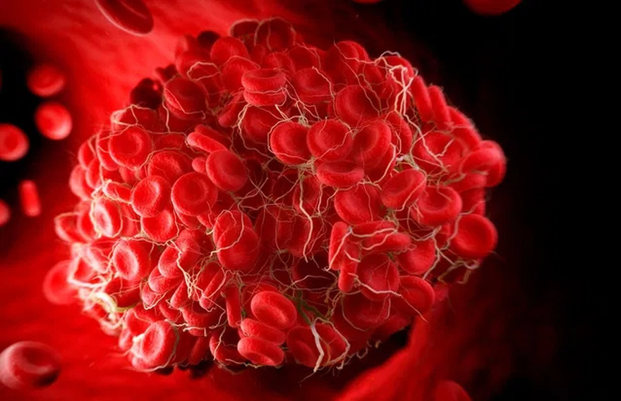Doctors reveal the one bl00d type which has the highest risk of getting stomach canc3r