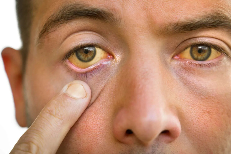 When an internal canc3r sends war:ning signals to your eyes, don’t ignore them!
