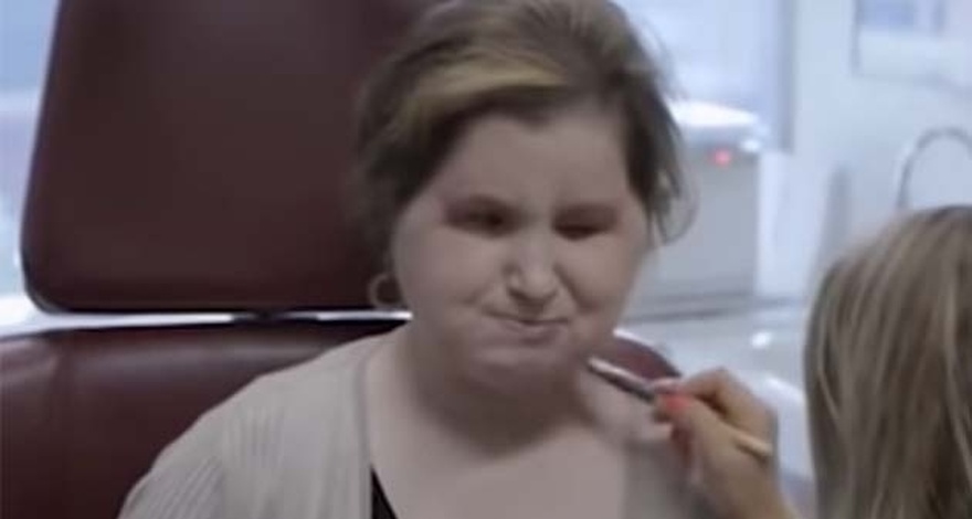 The amazing story of Katie Stubblefield: She became the youngest person to receive a face transplant
