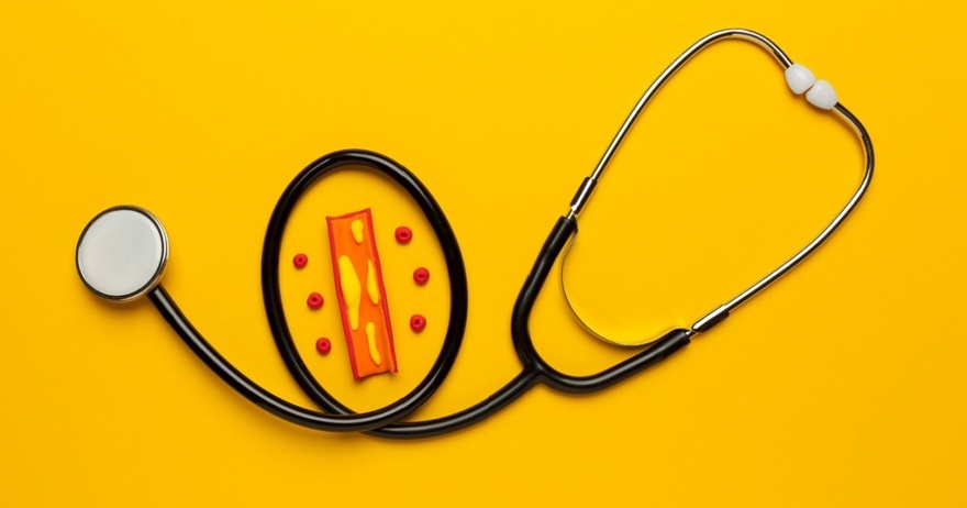 10 Foods That You Should Eat Daily For Clean Arteries