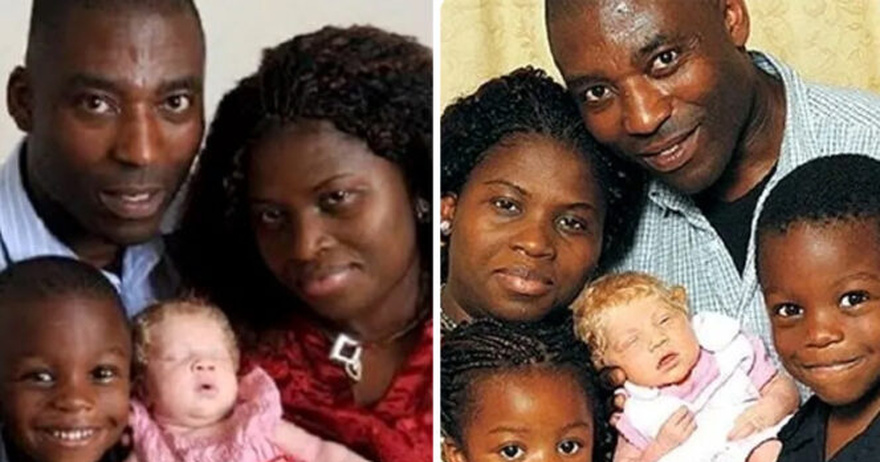 Black couple gives birth to blonde, blue-eyed child who they call “a miracle baby”